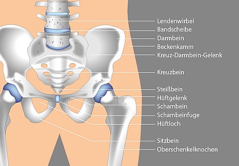 Die Hüfte: Aufbau und Funktion  Wann brauche ich eine Hüftprothese